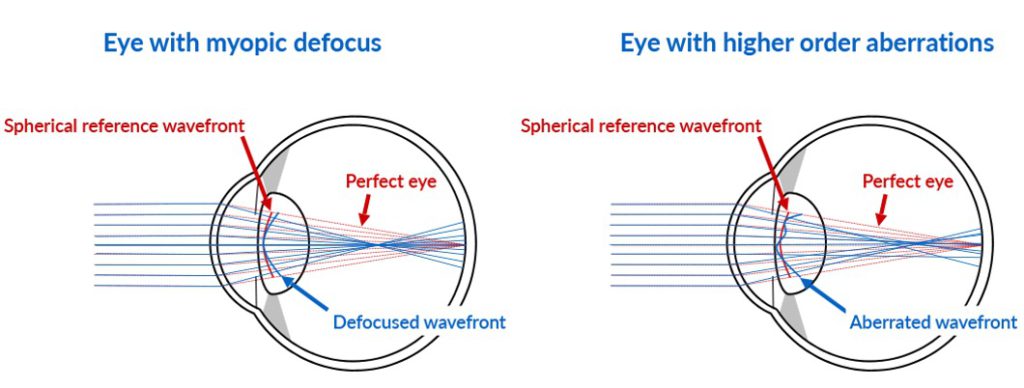wavefront guided contact lens